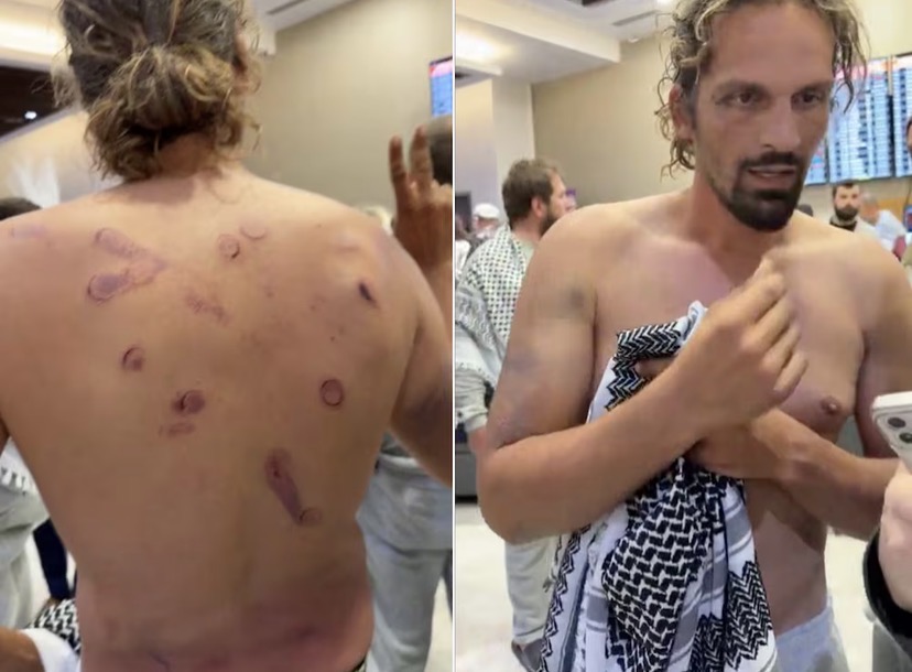 Activistas de la Flotilla Humanitaria Reportan Lesiones y Abusos Durante Detención Israelí