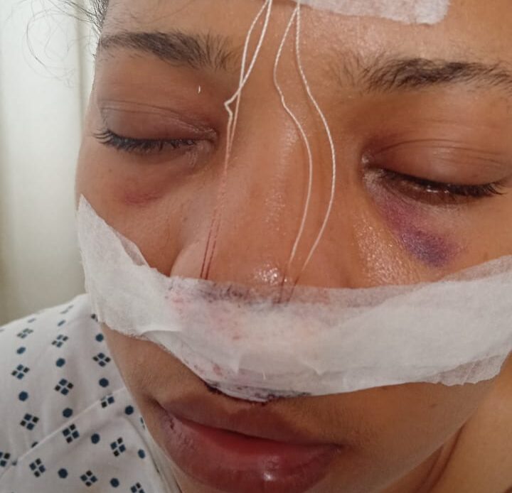 Mujer Reporta Agresión por Persona en Situación de Calle en la Autopista Duarte