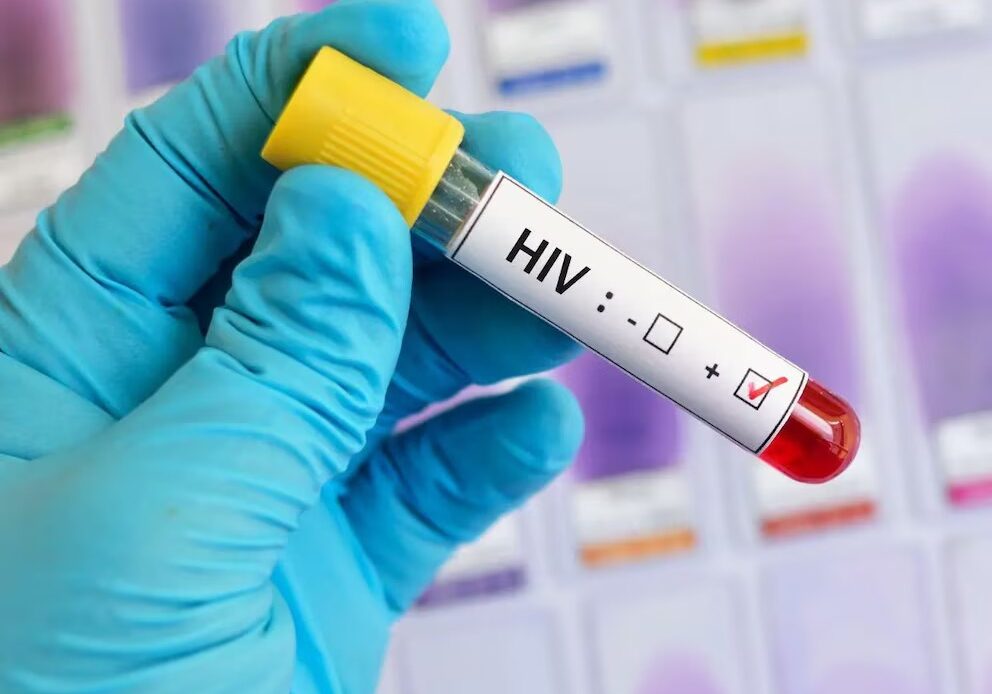Preocupación en República Dominicana: 38% de Pacientes con VIH sin Tratamiento