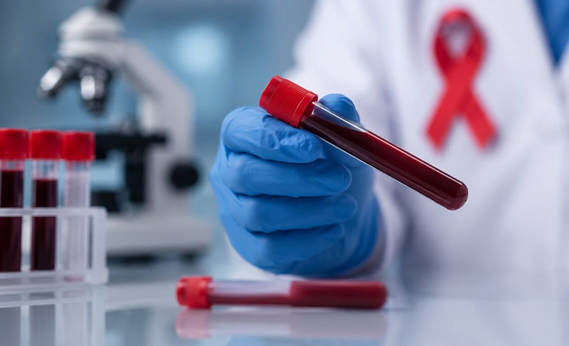 Autoridades dominicanas aclaran cifras del VIH: ¿Más diagnósticos o incremento de contagios?