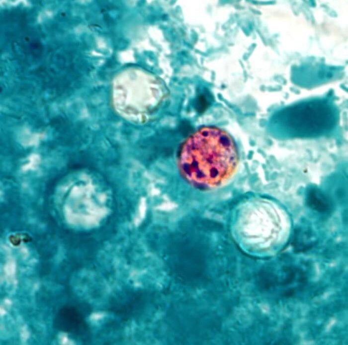 Investigación de los CDC por brote de Cyclospora: Más de 400 afectados en 18 estados de EE. UU.