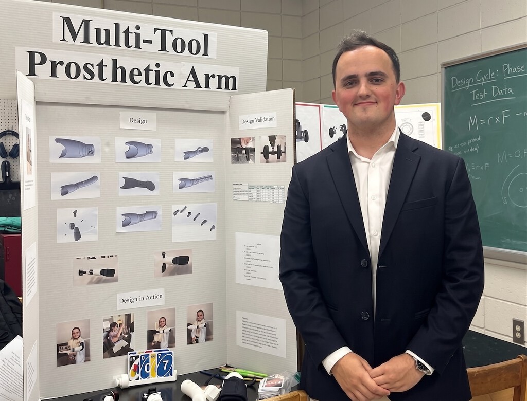 Estudiante de Ingeniería Desarrolla una Prótesis Multifuncional Impresa en 3D para su Hermana Menor
