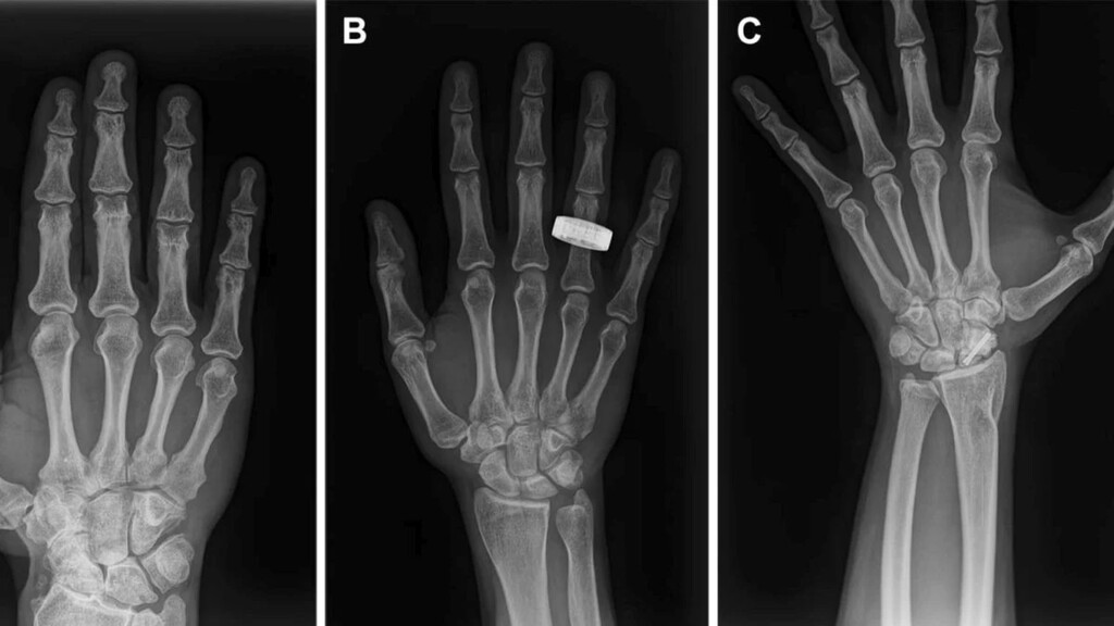 Astronautas realizan las primeras radiografías de diagnóstico en órbita, marcando un hito para la medicina espacial