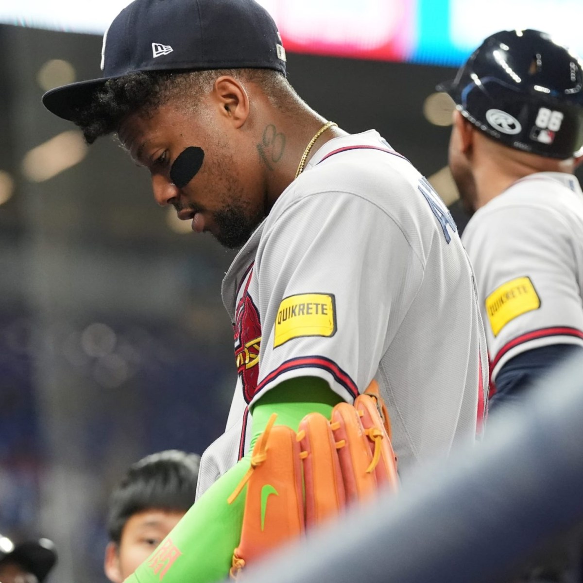 Ronald Acuña Jr. Podría Iniciar Rehabilitación Durante el Receso del Juego de Estrellas