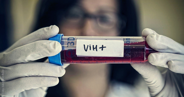 Nuevo Enfoque Integral Disminuye la Mortalidad por VIH en un 74%