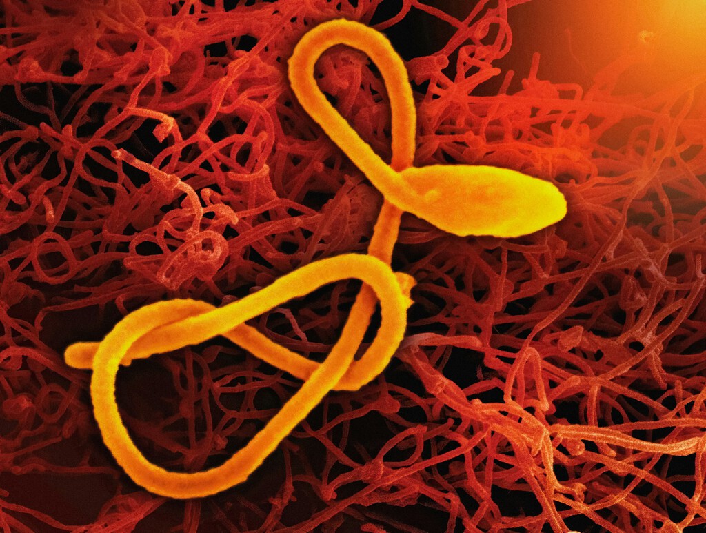 África enfrenta una epidemia de Ébola sin precedentes, la más rápida de la historia y sin tratamiento específico
