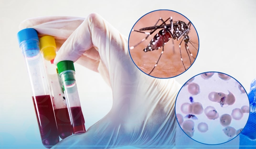 República Dominicana Registra 338 Casos de Dengue y 137 de Malaria en lo que va de 2026