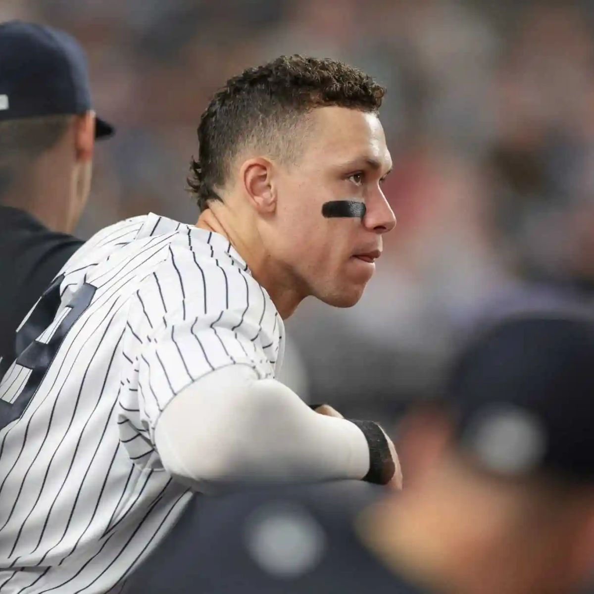 Aaron Judge Sale del Partido de los Yankees por Molestia en la Pierna Derecha