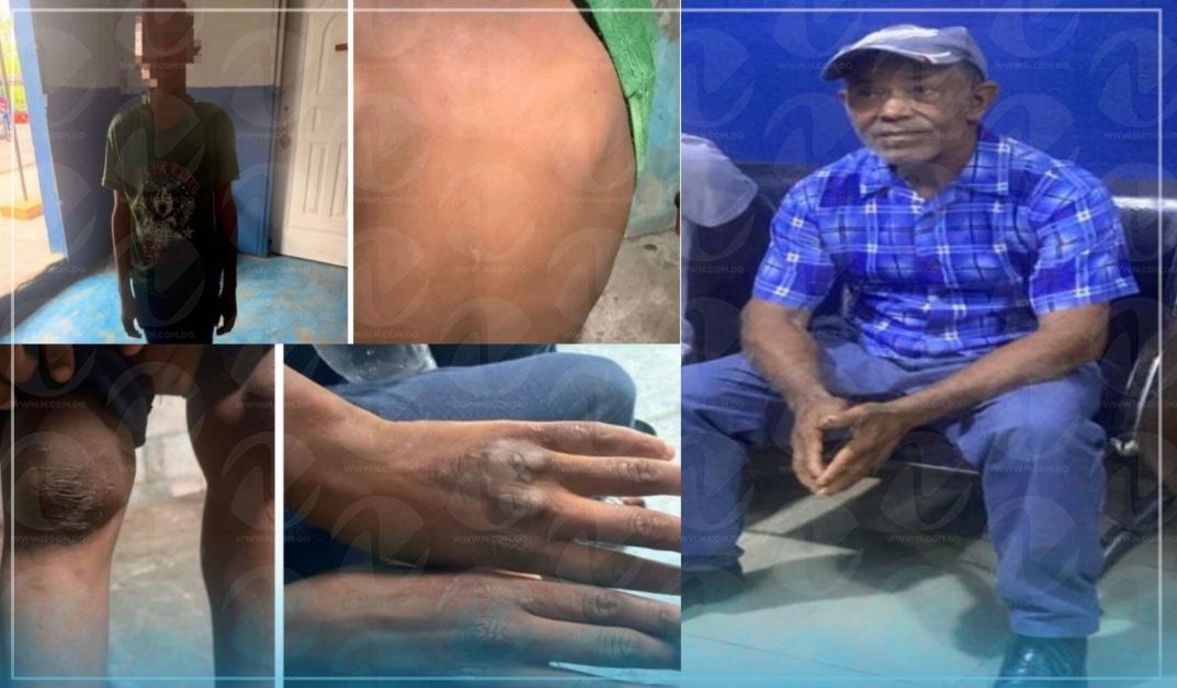 Rescate de menores en San Cristóbal revela patrón de maltrato, trabajos forzados y privación de alimentos